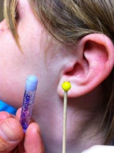 Foreign body removal from ear