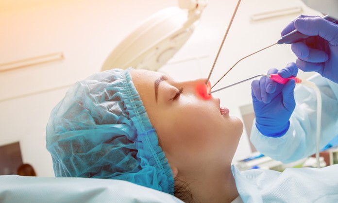 Functional endoscopic sinus surgery