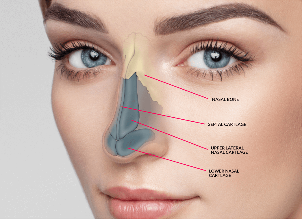 Rhinoplasty surgery