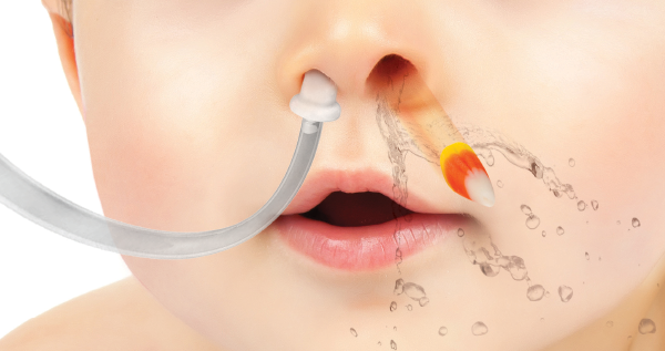Foreign body removal from nose
