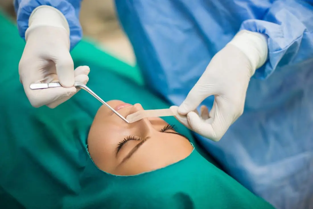 Septoplasty