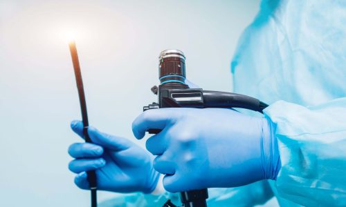 Endoscopic skull base surgery